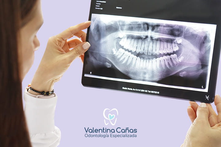 Descodificación Dental - Comprende el mensaje emocional detrás de tus dientes Descodificación dental en Cali - Relación entre emociones y salud bucal con la Dra. Valentina
