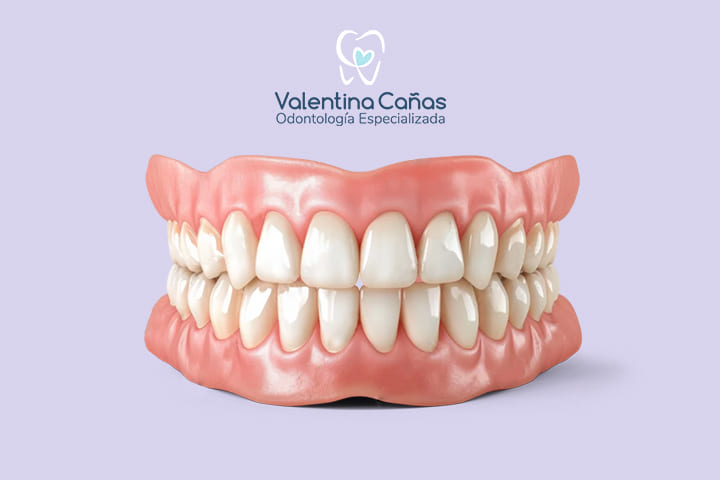 Prótesis Dentales - Rehabilitación oral personalizada en Cali Prótesis dentales fijas y removibles en Cali - Dra. Valentina Cañas